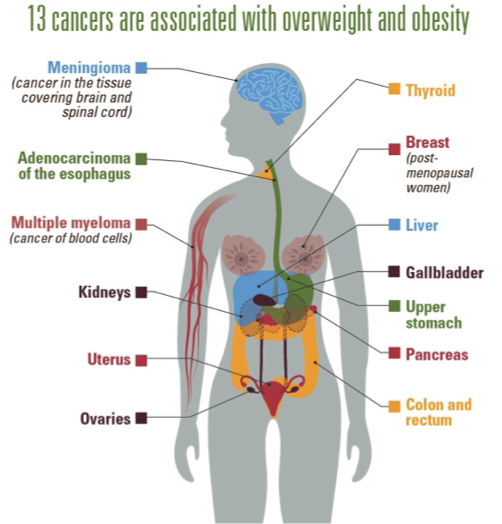 Stressful Living Invites Cancer, Excessive Greed Leads to Metabolic Disorders